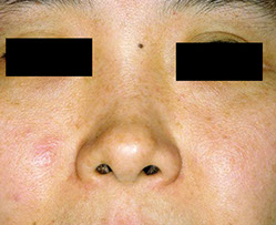after medlite_jinanclinic_1
