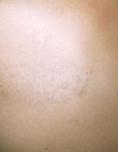 after medlite_weinstein_1