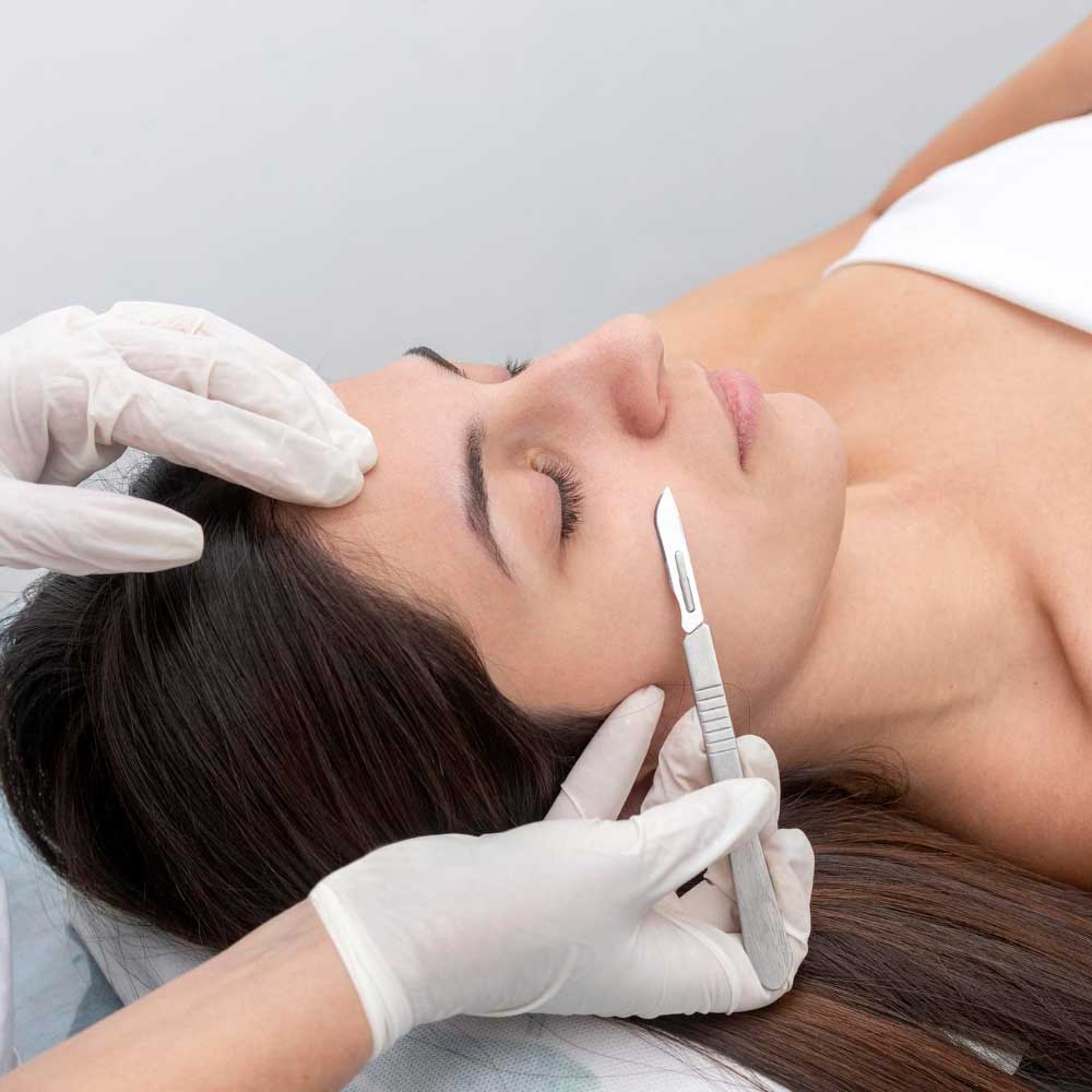 Dermaplaning