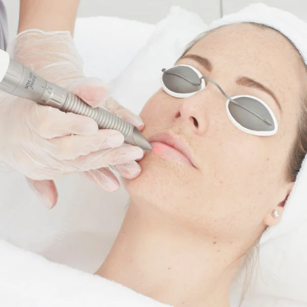 Skin Rejuvenation