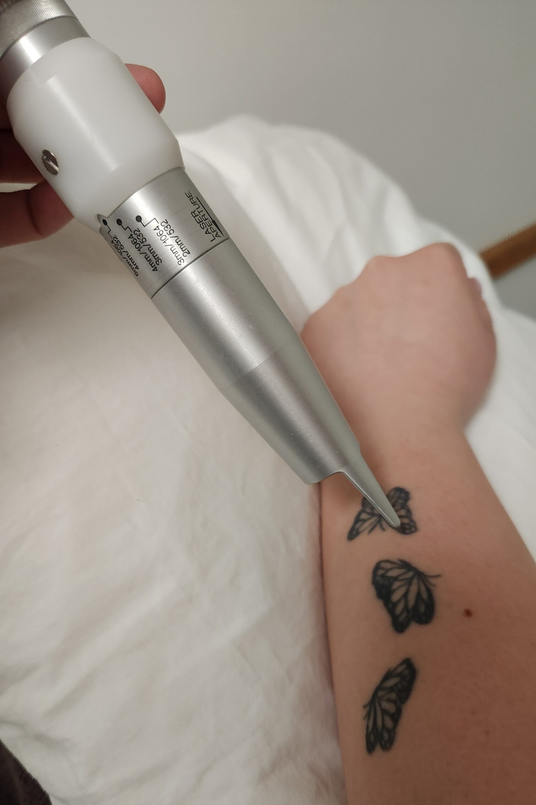 Tattoo Removal & Skin Rejuvenation