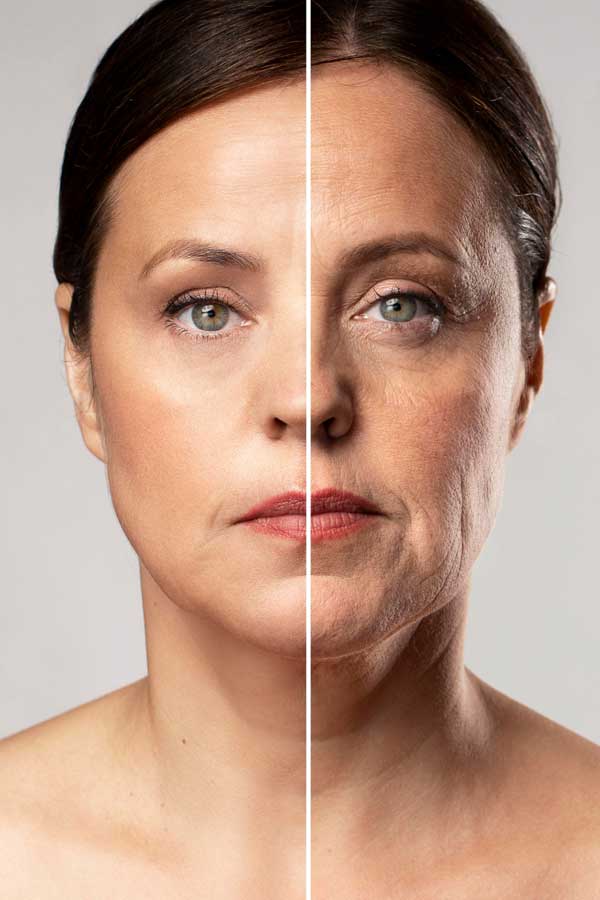 Skin Rejuvenation